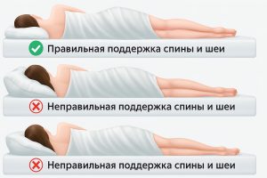 Инфографика: правильная и неправильная поддержка спины и шеи во сне на боку — верный и ошибочные примеры.